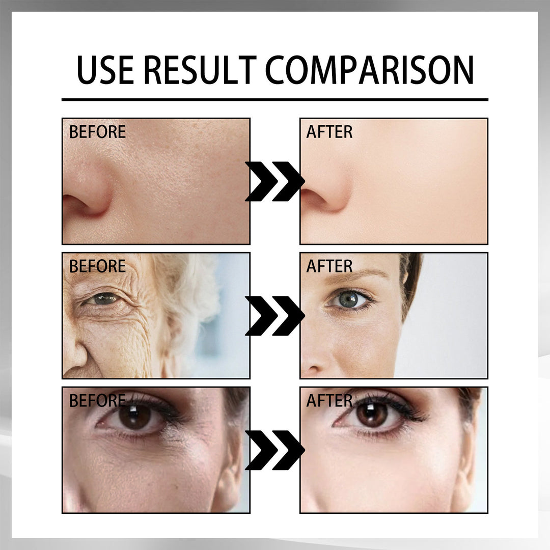 Snail Cream transforms skin, reducing lines for a radiant look.